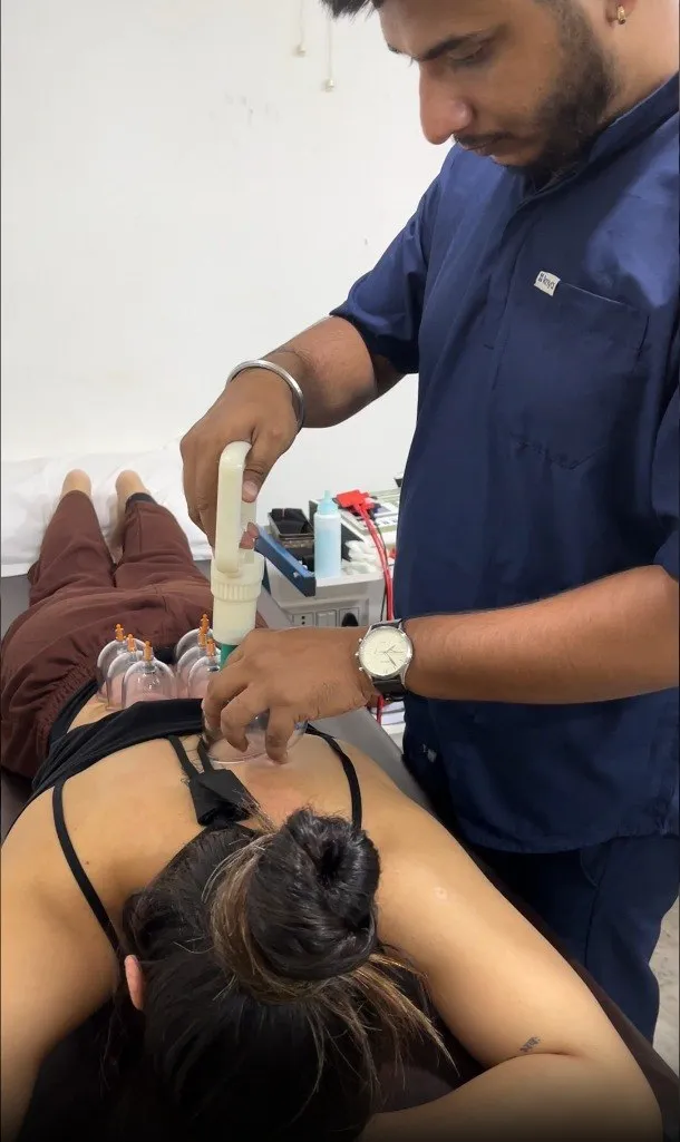 Clinical Cupping